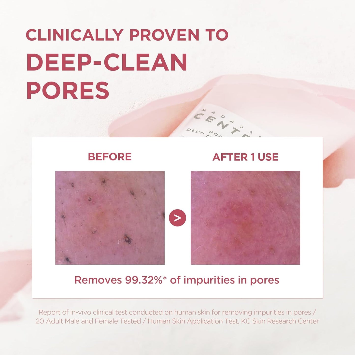 SKIN1004 Poremizing Madagascar Centella Cleanser 125ml | Limpieza profunda y poros refinados