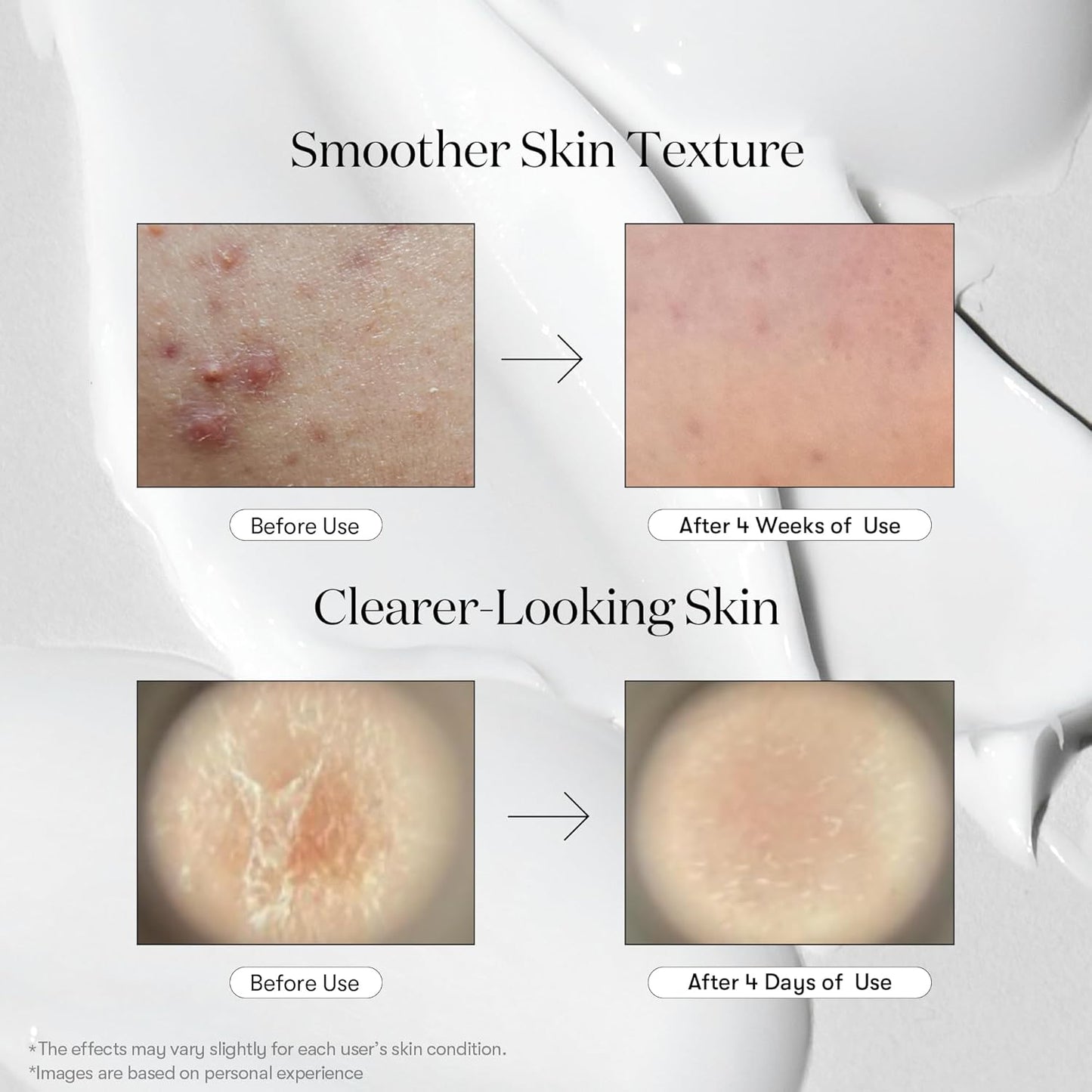 VT Cosmetics Reedle Shot 300 Serum 50ml | Renovación y piel luminosa